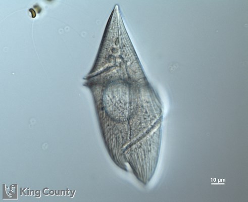 Photo of Gyrodinium spirale